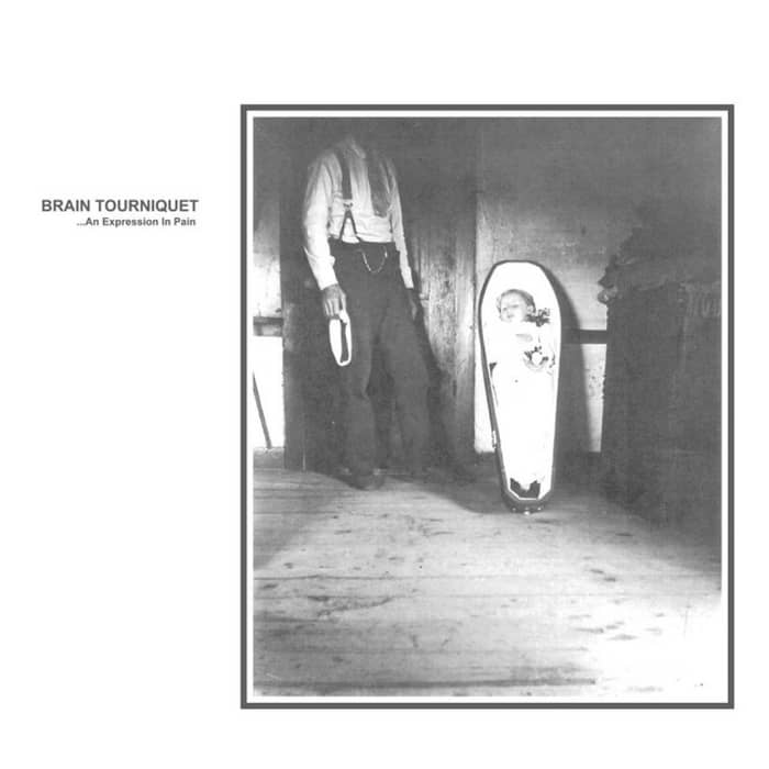 Brain Tourniquet cover image
